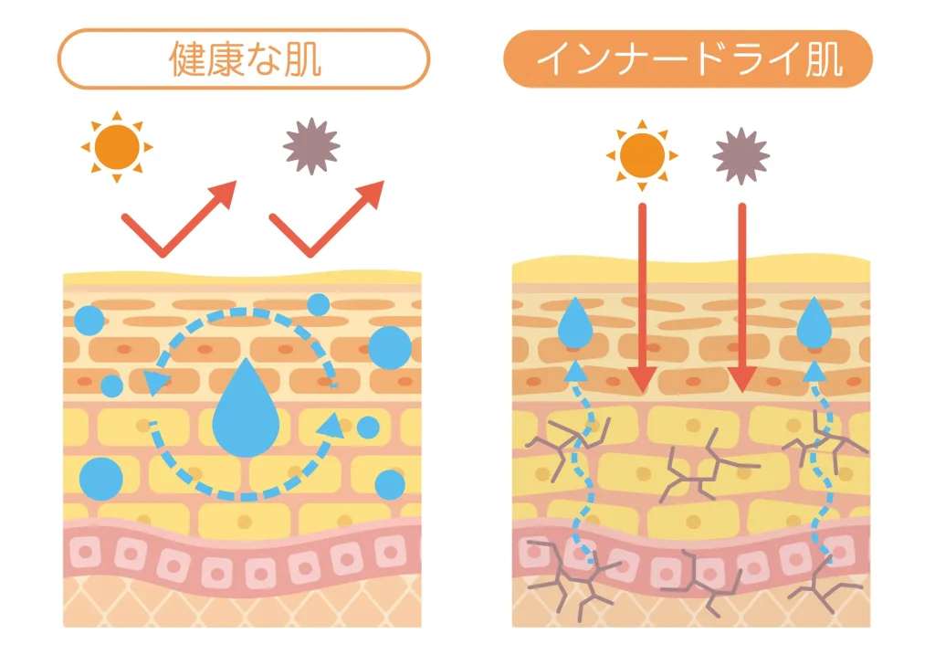 ニキビメディカルクリニック 健康な肌と混合肌(インナードライ)の違い